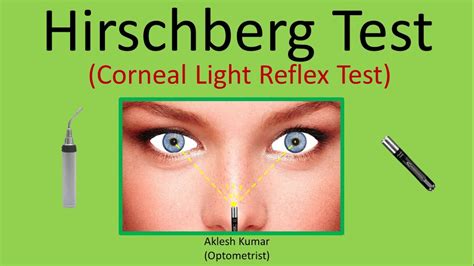 Corneal Reflex Test .
